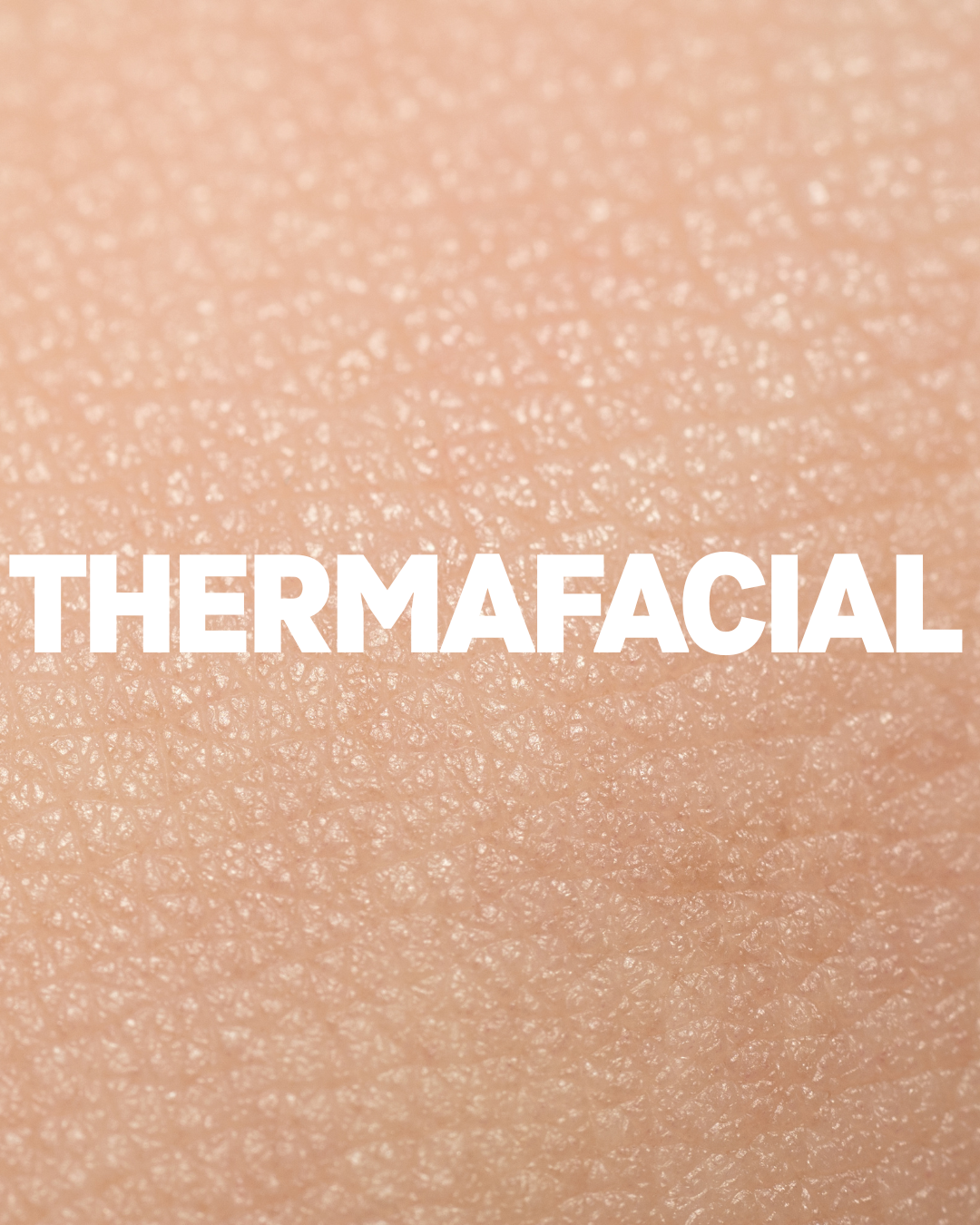 ThermaFacial treatment
